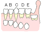 乳歯から永久歯へ1