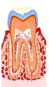 虫歯の治療法1