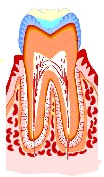 虫歯の治療法2