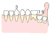 乳歯から永久歯へ5