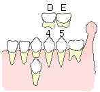 乳歯から永久歯へ4
